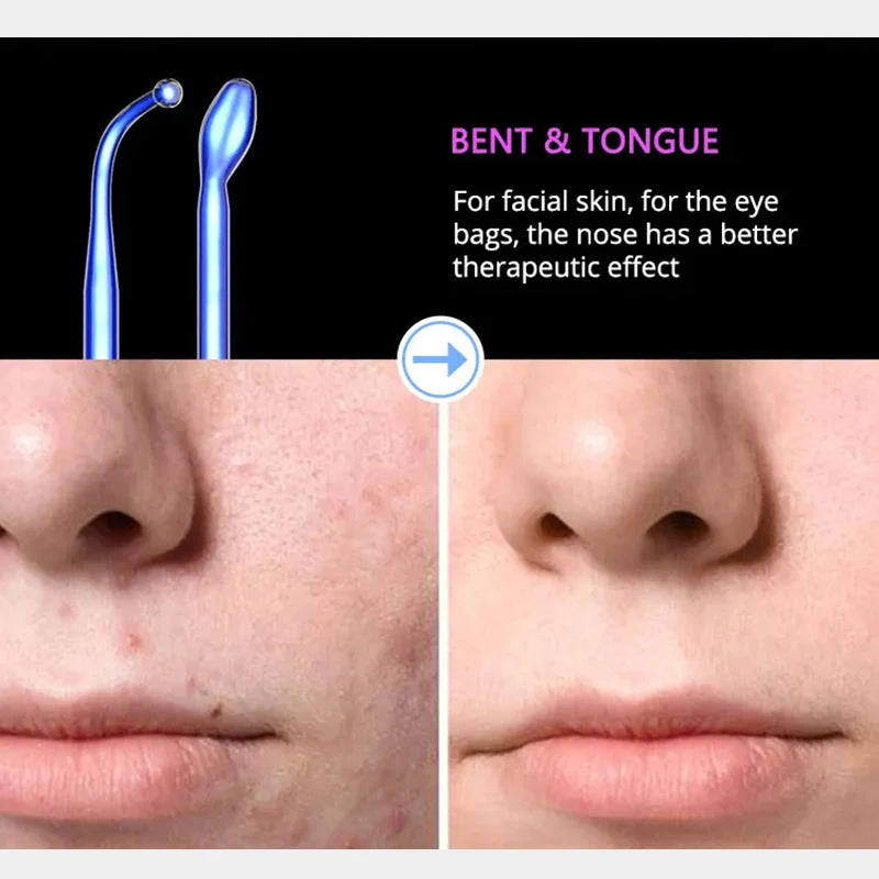 PureSky LED Facial Wand